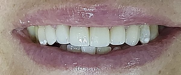 06