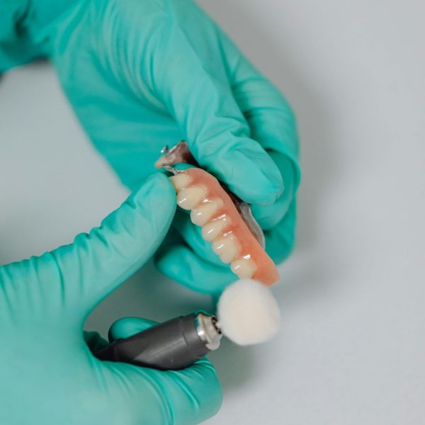Rehabilitación Oral