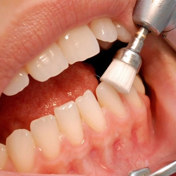 Periodoncia