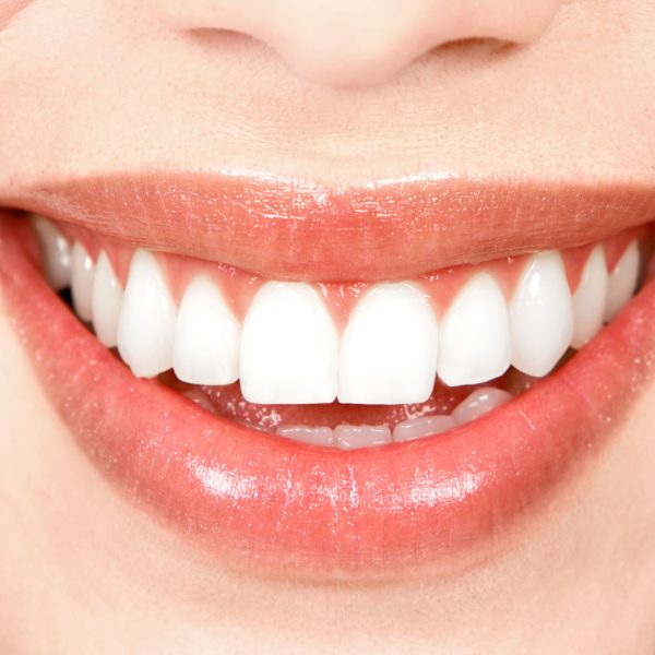 diseno-de-sonrisa-dentioral